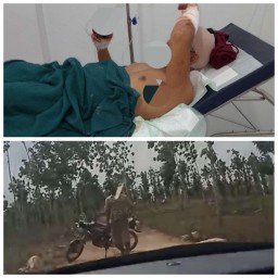 Pembacokan Wartawan di Tuban Harus Di Usut Tuntas. APH Segera Tangkap Oknum Preman